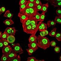 OTX2 Antibody in Immunocytochemistry (ICC/IF)