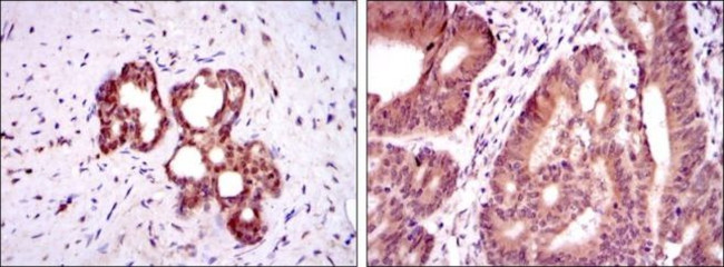 OTX2 Antibody in Immunohistochemistry (Paraffin) (IHC (P))