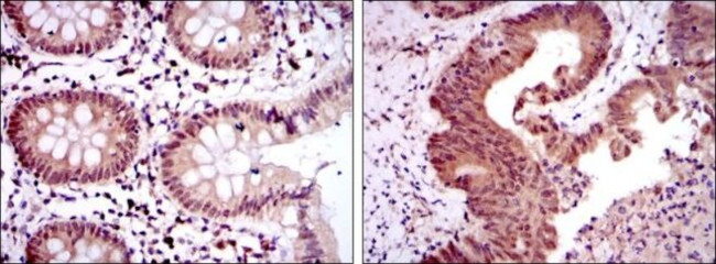 OTX2 Antibody in Immunohistochemistry (Paraffin) (IHC (P))