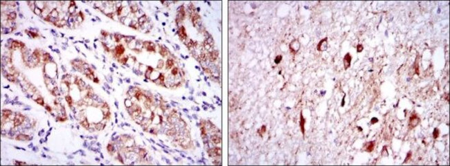 OTX2 Antibody in Immunohistochemistry (Paraffin) (IHC (P))