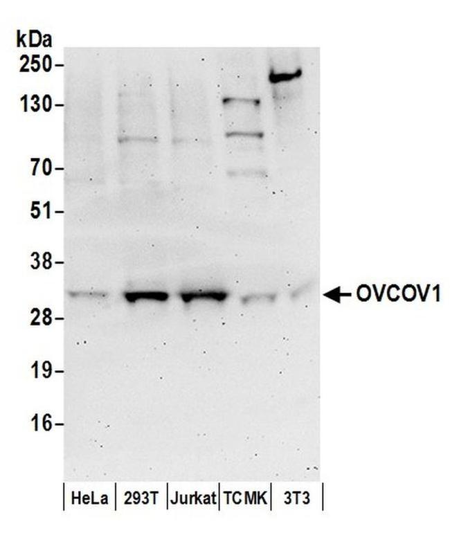 OVCOV1 Antibody in Western Blot (WB)