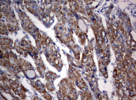 OXSM Antibody in Immunohistochemistry (Paraffin) (IHC (P))