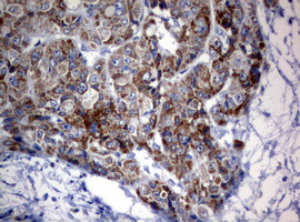 OXSM Antibody in Immunohistochemistry (Paraffin) (IHC (P))