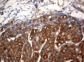 OXSM Antibody in Immunohistochemistry (Paraffin) (IHC (P))