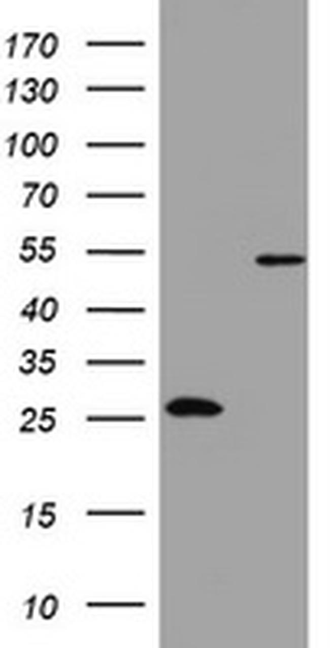 OXSM Antibody in Western Blot (WB)