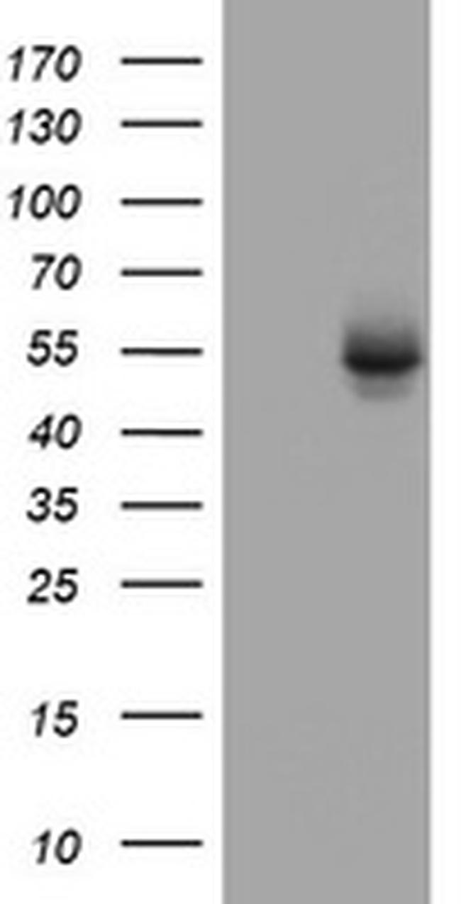 OXSM Antibody in Western Blot (WB)