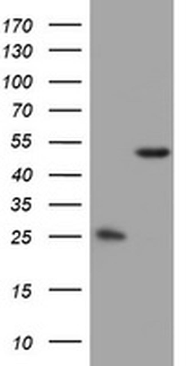 OXSM Antibody in Western Blot (WB)