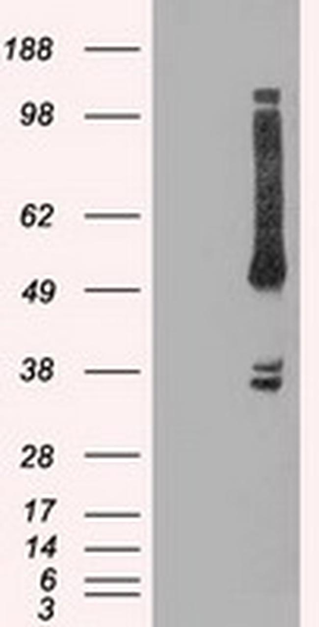 OXSR1 Antibody in Western Blot (WB)