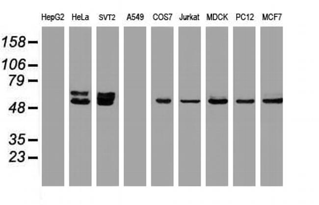 OXSR1 Antibody in Western Blot (WB)