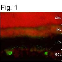 Opsin 4 Antibody in Immunocytochemistry (ICC/IF)