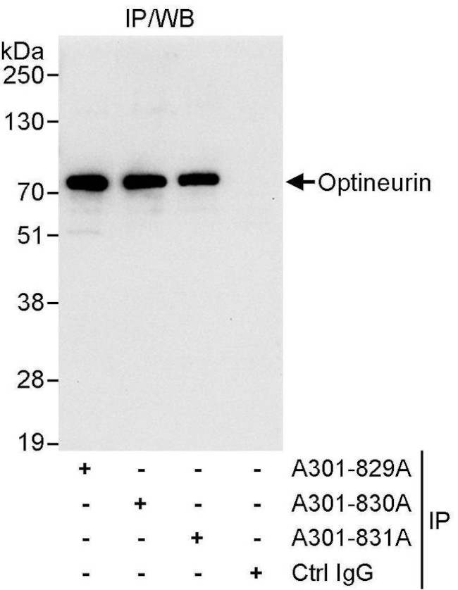 Optineurin Antibody in Immunoprecipitation (IP)