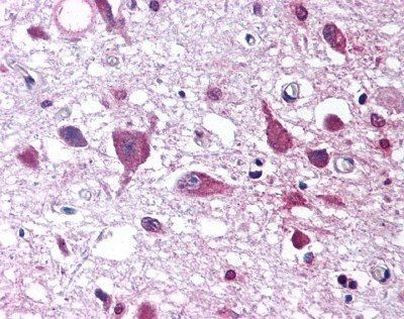 Orexin A Antibody in Immunohistochemistry (Paraffin) (IHC (P))