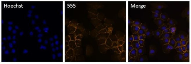 P-cadherin Antibody in Immunocytochemistry (ICC/IF)