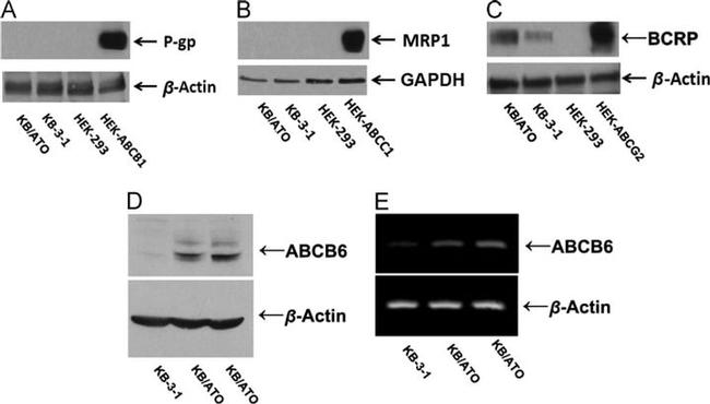 P-Glycoprotein Antibody in Western Blot (WB)