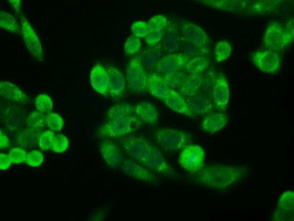 CDKN2A (p16INK4a) Antibody in Immunocytochemistry (ICC/IF)