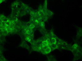 P16 Antibody in Immunocytochemistry (ICC/IF)