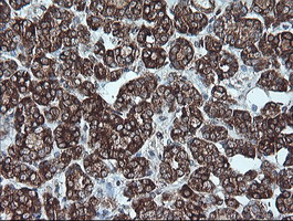 P16 Antibody in Immunohistochemistry (Paraffin) (IHC (P))