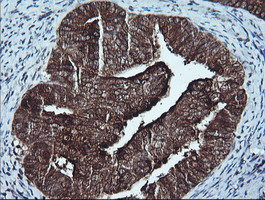 CDKN2A (p16INK4a) Antibody in Immunohistochemistry (Paraffin) (IHC (P))