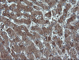 P16 Antibody in Immunohistochemistry (Paraffin) (IHC (P))