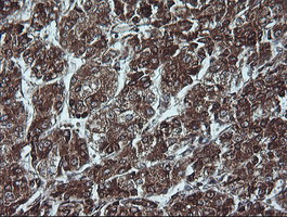 P16 Antibody in Immunohistochemistry (Paraffin) (IHC (P))