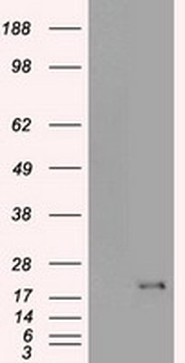 P16 Antibody in Western Blot (WB)