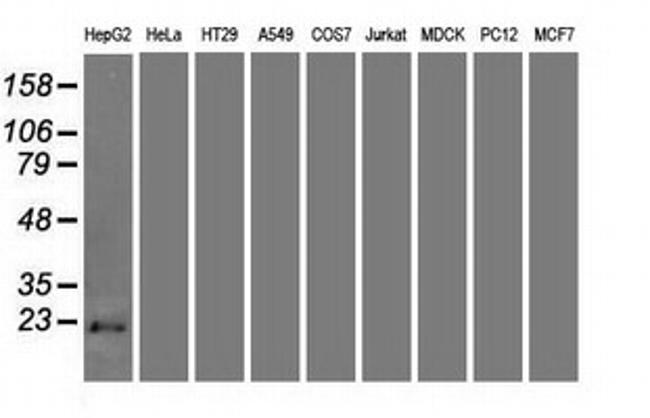 CDKN2A (p16INK4a) Antibody in Western Blot (WB)