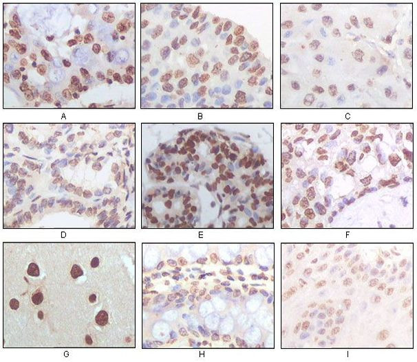 p16INK4a Antibody in Immunohistochemistry (Paraffin) (IHC (P))