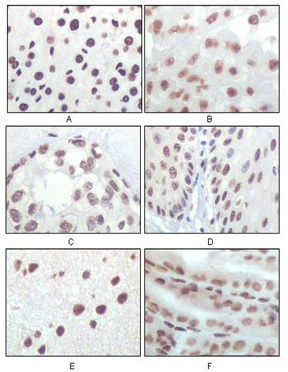 p16INK4a Antibody in Immunohistochemistry (Paraffin) (IHC (P))