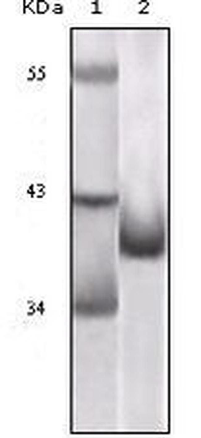 p16INK4a Antibody in Western Blot (WB)