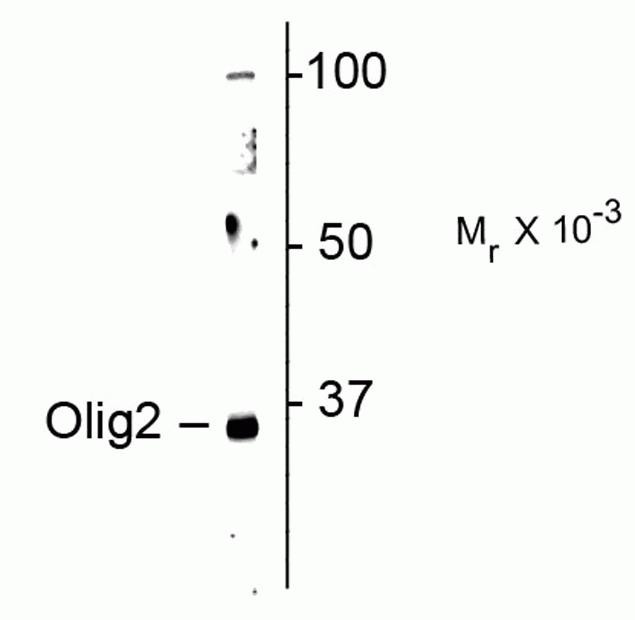 OLIG2 Antibody in Western Blot (WB)