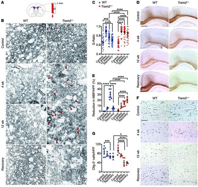 OLIG2 Antibody in Immunohistochemistry (IHC)