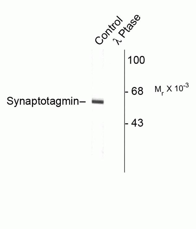 Phospho-Synaptotagmin 1 (Thr202) Antibody in Western Blot (WB)