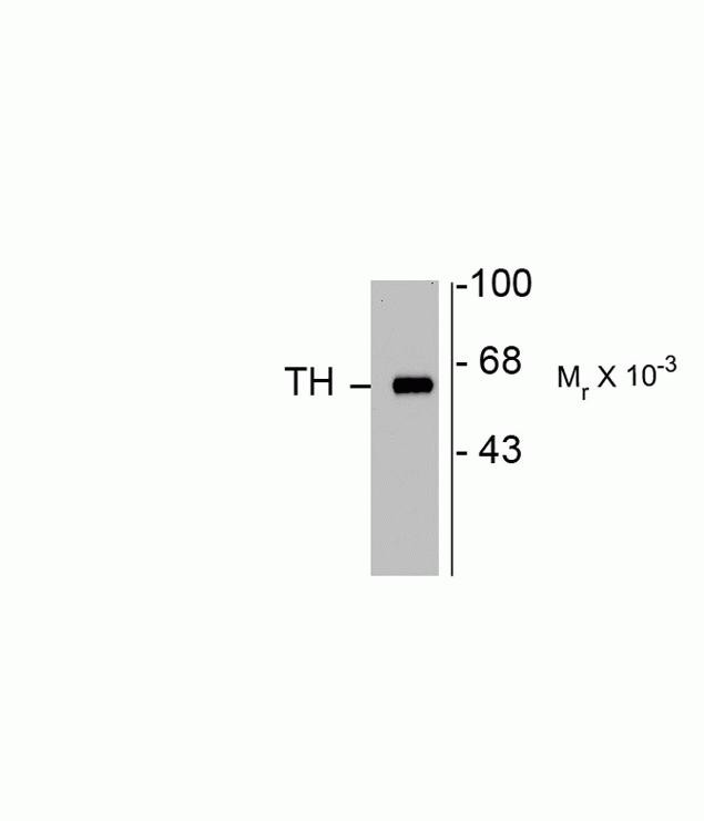 Tyrosine Hydroxylase Antibody in Western Blot (WB)