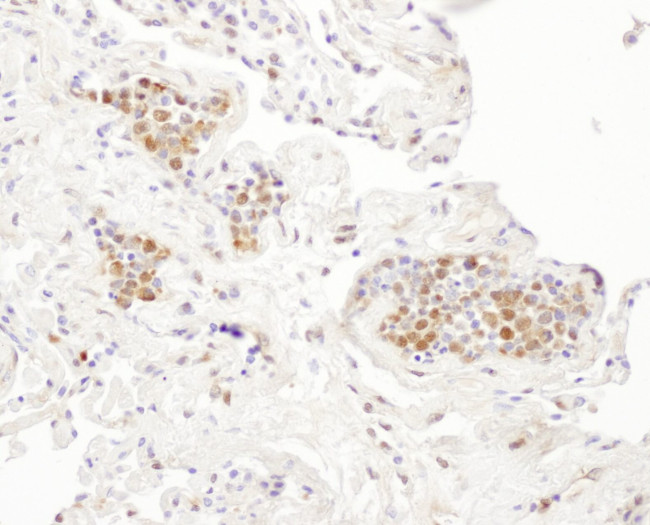 P23 Antibody in Immunohistochemistry (IHC)