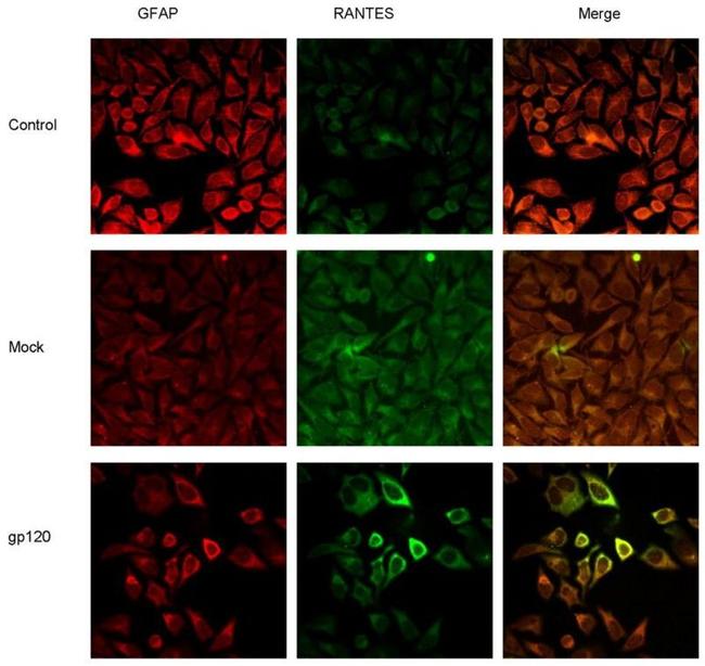 CCL5 (RANTES) Antibody in Immunocytochemistry (ICC/IF)