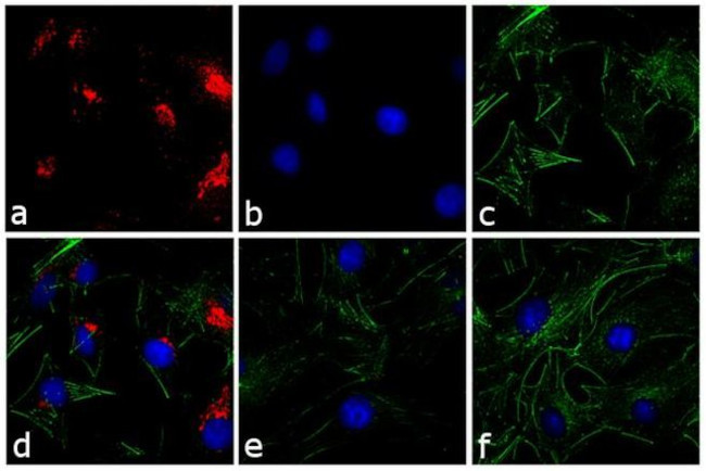 Rabbit IgG (H+L) Secondary Antibody in Immunocytochemistry (ICC/IF)