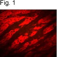 P2Y2 Antibody in Immunohistochemistry (IHC)