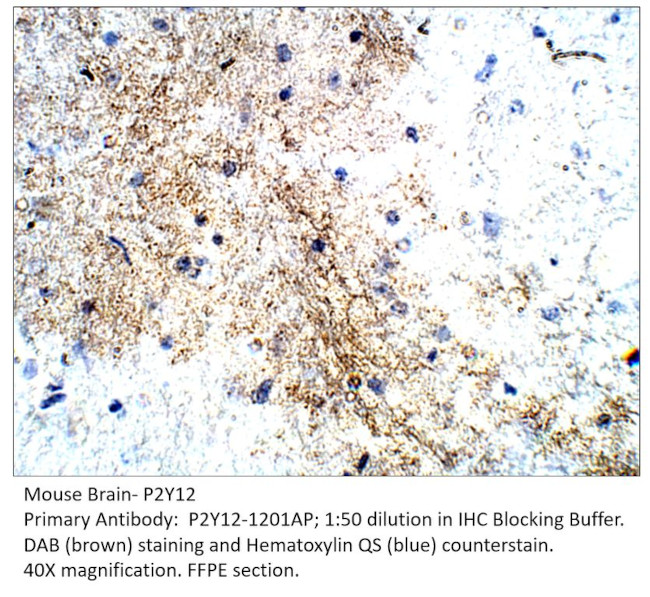 P2Y12 Antibody in Immunohistochemistry (IHC)