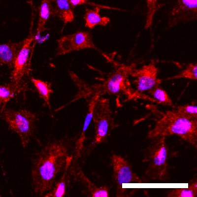 P2Y12 Antibody in Immunocytochemistry (ICC/IF)