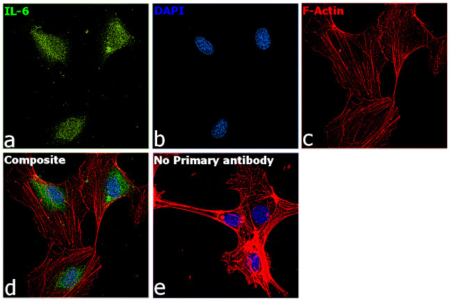 IL-6 Antibody in Immunocytochemistry (ICC/IF)