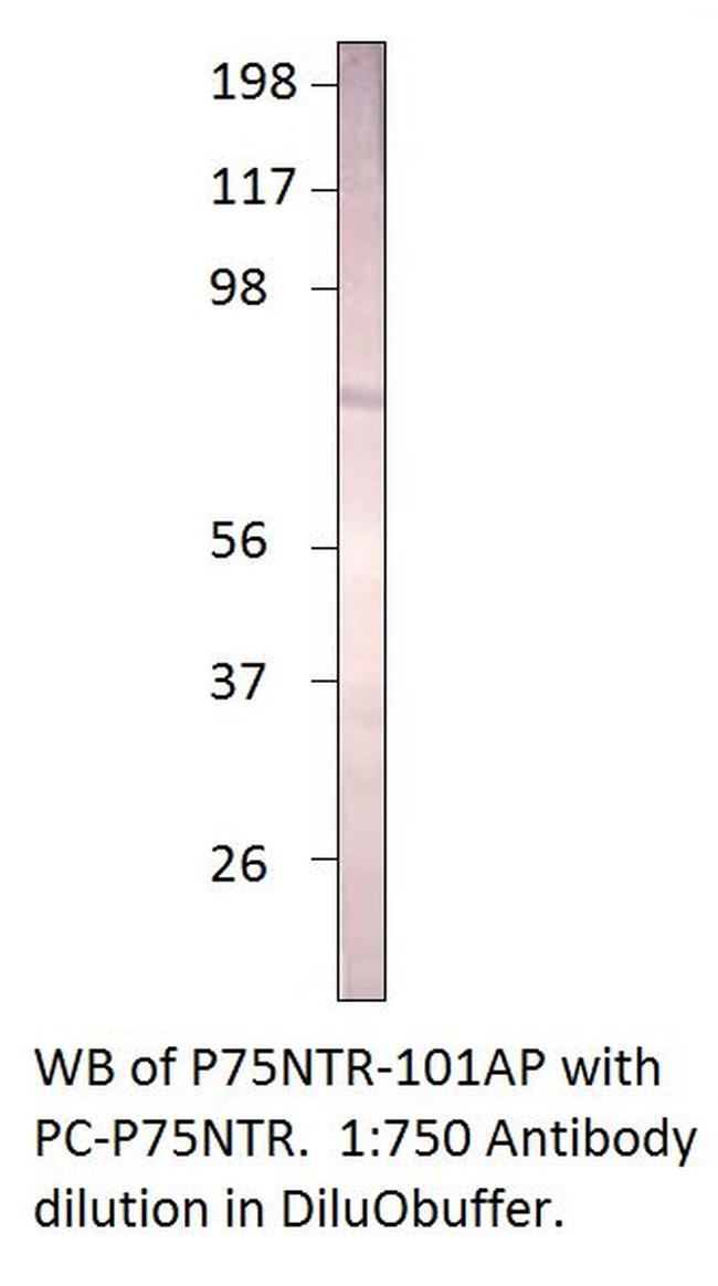 p75 NGF Receptor Antibody in Western Blot (WB)