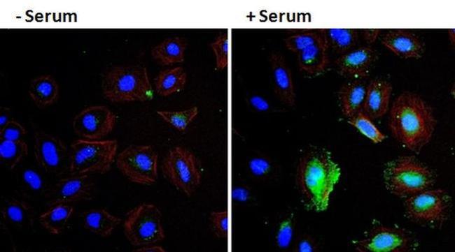 VEGF Antibody