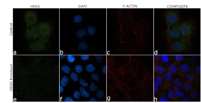 H-Ras Antibody in Immunocytochemistry (ICC/IF)