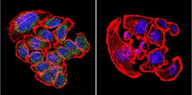 KDEL Antibody in Immunocytochemistry (ICC/IF)