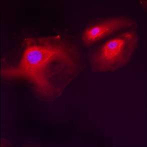 GRP78 Antibody in Immunocytochemistry (ICC/IF)