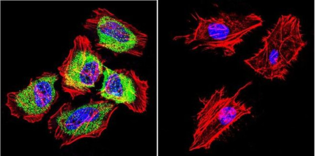 HSP27 Antibody in Immunocytochemistry (ICC/IF)