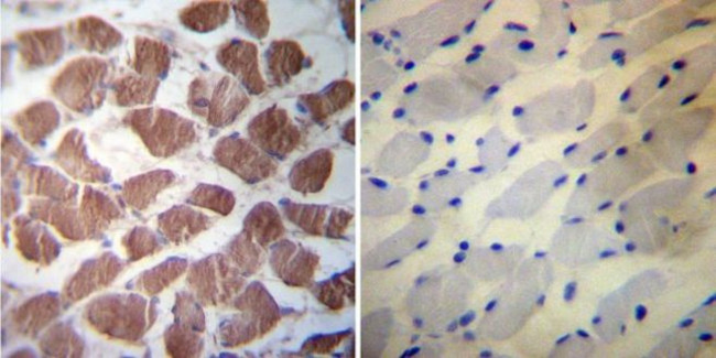 HSP27 Antibody in Immunohistochemistry (Paraffin) (IHC (P))