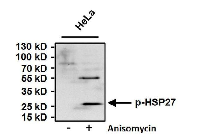 Phospho-HSP27 (Ser15) Antibody