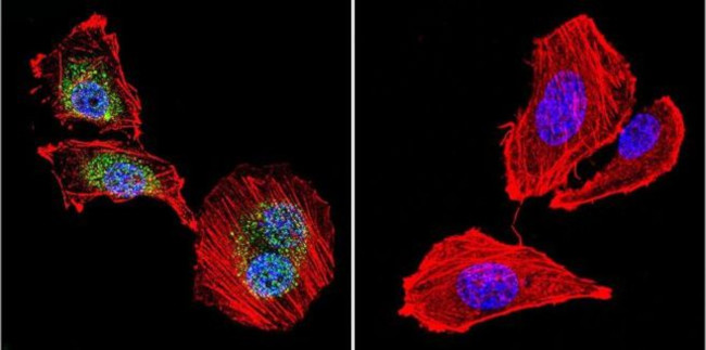 NFATC4 Antibody in Immunocytochemistry (ICC/IF)