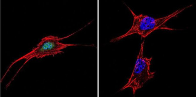 NFAT5 Antibody in Immunocytochemistry (ICC/IF)